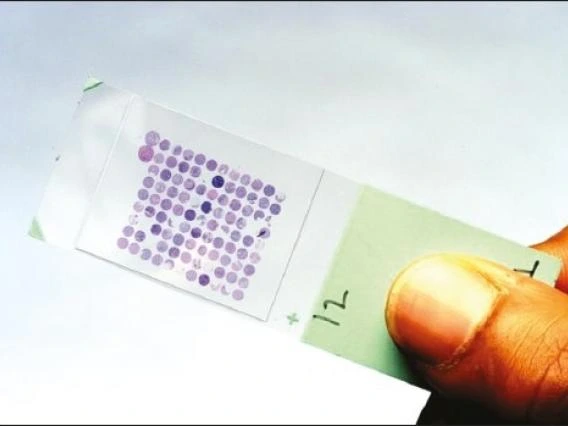 Tissue Acquisition and Cellular/Molecular Analysis