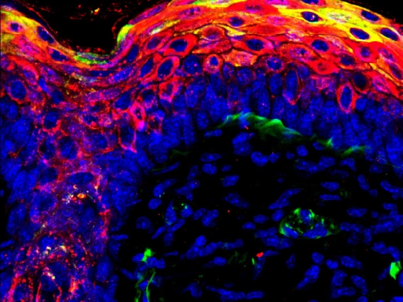 Immunostaining Stock Image