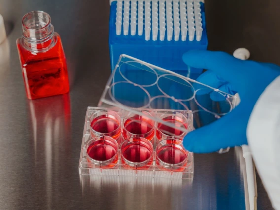 Cell Cultures Being Prepared for Pipette