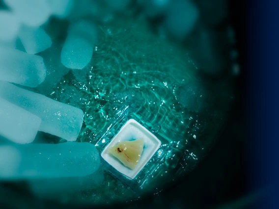Tumor Sample Floating in Frozen Bath