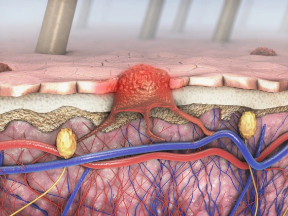 Layers of the skin.
