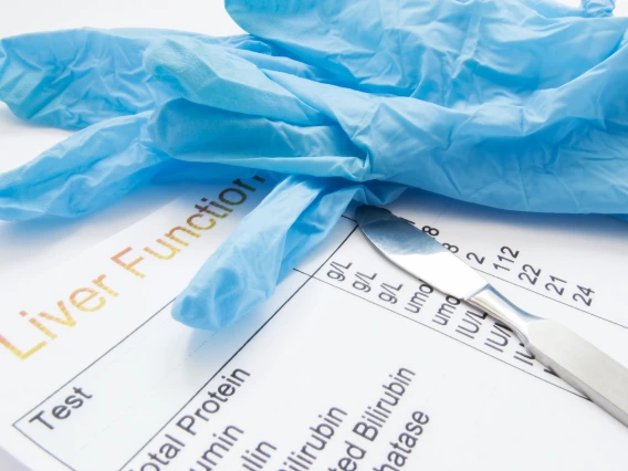 Paper with liver test results and  blue medical gloves on top.