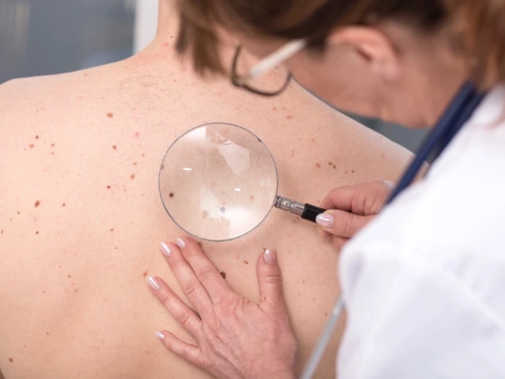 Doctor screening skin