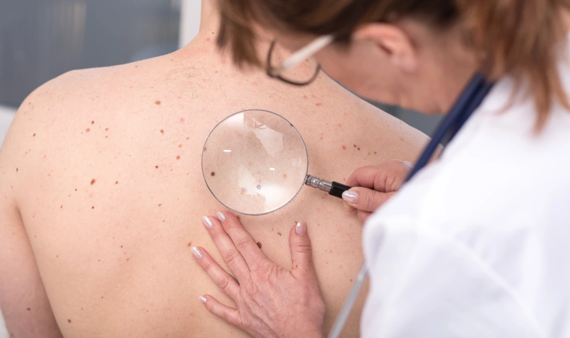 Doctor screening skin