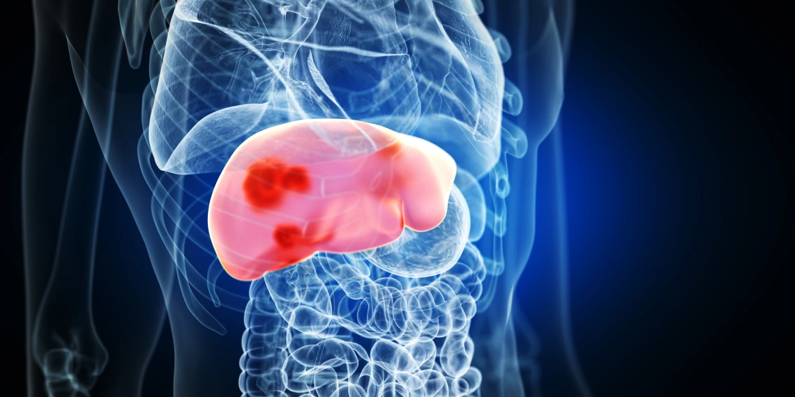 A section of a person's liver as a drawing.