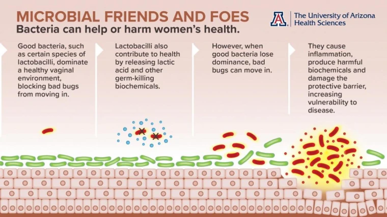 “Good” vaginal bacteria, shown here in green inhabiting the vaginal tissue, appear to support women’s health, while “bad” bacteria, shown here in red, are associated with disease.