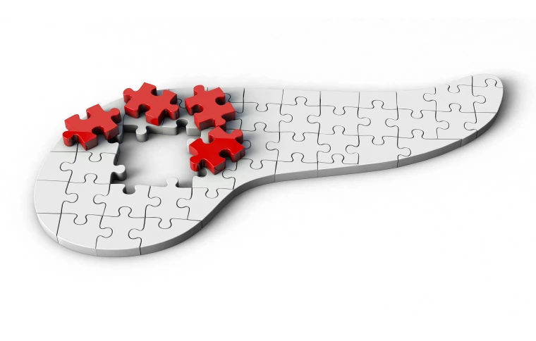 White puzzle piece pancreas with red puzzle pieces pulled out and resting on top.