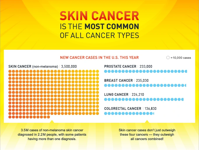 A chart that lists the different types of skin cancer types.