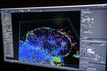 Imaging shows H. pylori infection in gastric organoids, which are miniature organs with realistic microanatomy that were developed in a lab from tissue samples.