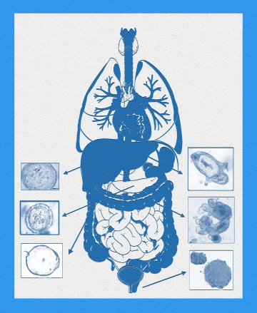 Diagram of body with organoid examples