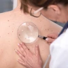 Doctor screening skin