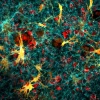 Image courtesy of U of A Comprehensive Cancer Center and its Nikon Center of Excellence microscopy core