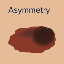 Asymmetry SCI graphic.