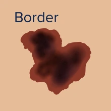 Border skin cancer example.