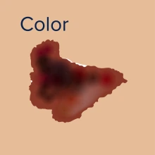 Color for skin cancer